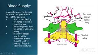 Topic Presentation Odontoid fractures [upl. by Milan]