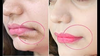 This 1Minute Technique will Remove Mouth Wrinkles amp Lift Corners Of Your Mouth Instantly [upl. by Thomasine]