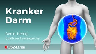 Nahrungsmittelunverträglichkeiten kranker Darm  Alternativmedizin  QS24 Gesundheitsfernsehen [upl. by Arehc]