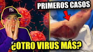 ALERTA por VIRUS FLiRT o KP3 nueva variante del COVID [upl. by Gertrude307]