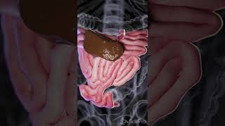 Understanding Small Bowel Perforation anatomy biology 3danimation [upl. by Reid]