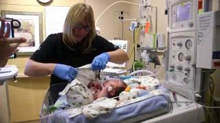 Causes Behind Premature Births [upl. by Nico37]