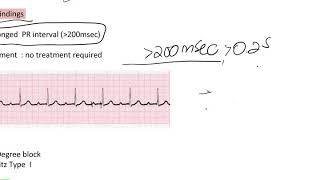 ARRHYTHMIA Part 4 bradyArrhythmias [upl. by Suk]