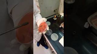 URINE CULTURE SENSTIVITY hospital laboratorylife scienceclass medicallaboratory sciencelab [upl. by Newg]