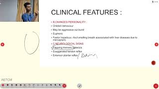 Hepatic encephalopathy [upl. by Rita]