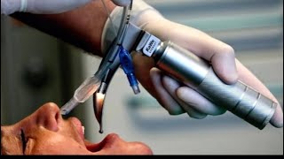 Endotracheal Tube ETT Intubation [upl. by Aryan]