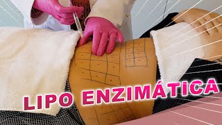 Resultados da Lipo Enzimática  Dr Luciane Bravi Explica [upl. by Lewap]