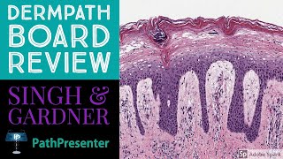 Dermpath Board Review 100 Classic Cases [upl. by Ayian]