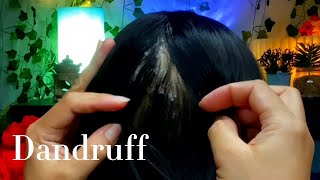 ASMR Satisfying Dandruff Removal Sleep Recovery Super Tingly  No Talking 😴🥱💤 [upl. by Ecirtnas523]