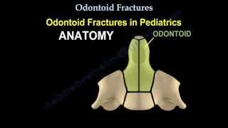 Odontoid Fractures  Everything You Need To Know  Dr Nabil Ebraheim [upl. by Drofnelg]