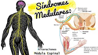 SÍNDROMES MEDULARES repaso y CASO CLÍNICO [upl. by Aryaz]