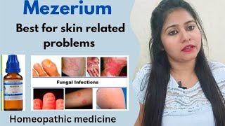 Mezereum Homeopathic medicine uses amp benefits  Mezereum best for skineye amp respiratory problems [upl. by Arundell847]