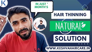 Control quot Hair Thinningquot In 2 Months ✅ All Naturally 🔥 keshvahaircare [upl. by Ultann89]