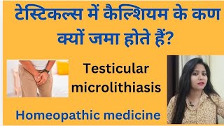 टेस्टिकल्स में कैल्शियम के कण क्यों जमा होते हैंTesticular microlithiasis symptomcause amp treatment [upl. by Elleoj]