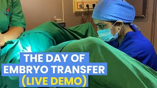 The Day of Embryo Transfer Live Demo  Dr Asha Gavade Umang Hospital [upl. by Woodhouse85]