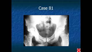 RADIOLOGY EXAM CASES [upl. by Afrika796]