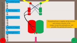 Tongue deviation in hypoglossal palsy [upl. by Tufts]