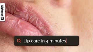 How To Get Rid Of Chapped Lips  Lip Care 101  From Exfoliating To Moisturizing ✨ [upl. by Faubion]