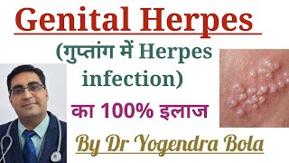 Genital Herpes Infection ke causes  symptoms and 100  treatment in Hindi Acyclovir  famciclovir [upl. by Hally]