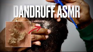 Dandruff Scratching ASMR  Removing Big Flakes From My Locs dandruffremovalasmr dreadlocksdandruff [upl. by Gregorio455]