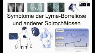 Symptome der LymeBorreliose und anderer Spirochätosen  Ganzer Film mit historischen Belegen [upl. by Aisak847]