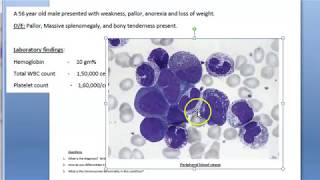 Pathology 357 b CML Chronic Myeloid Leukemia Case Study Philadelphia leukemoid reaction [upl. by Ahsitan397]