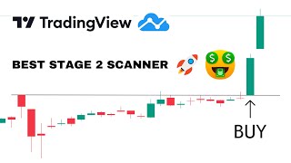 The ONLY TradingView scanner youll ever need [upl. by Akihsan]