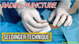 Radial puncture with Seldinger technique  tutorial  coronary angiography [upl. by Eilujna]