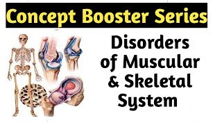 Disorders of Muscular amp Skeletal System  Movement and Locomotion Class 11  NEET Biology [upl. by Galang371]