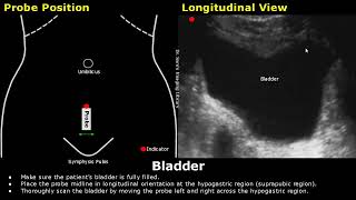 How to Scan The Bladder On Ultrasound  Probe Positioning  Transducer Placement  Abdominal USG [upl. by Ennairak]