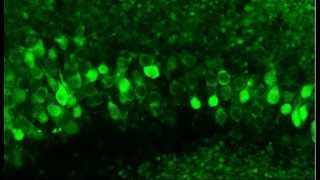 Monitoring neuronal activity in brain slices from a 2 year old Thy1GCaMP3 transgenic mouse [upl. by Mukul682]