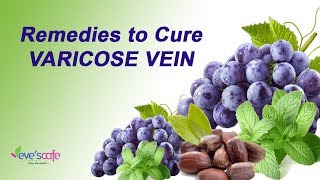 Natural Home Remedies to Cure Varicose Veins 100 Natural [upl. by Holly-Anne]