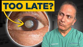 How to Detect Cataracts in Time [upl. by Leroy]