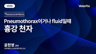 베터플릭스 Pneumothorax이거나 fluid일때  흉강 천자 [upl. by Doig]