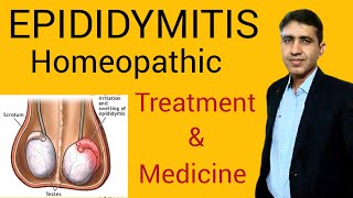 Epididymitis SymptomsCauses and Treatment Homeopathic medicine Testicular Pain DrRamdeo Lamoria [upl. by Aniz]