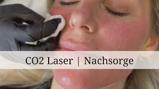 CO2 Laserbehandlung Nachsorge  Dr Ben Gehl [upl. by Nessah]