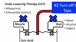 Understanding Gout [upl. by Uzzial]