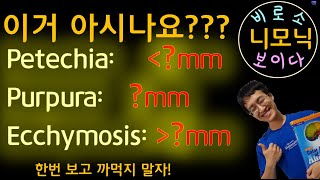 니모닉 Petechia purpura Ecchymosis [upl. by Kono54]