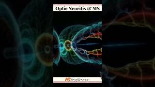 How To Recognize Optic Neuritis And MS [upl. by Yesnik143]