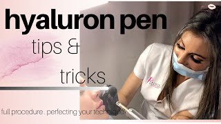 Hyaluron Pen Lip filler Tips amp Tricks Full Procedure [upl. by Ellives]