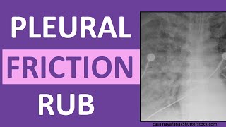 Pleural Friction Rub Lung Breath Sounds Abnormal [upl. by Ck897]