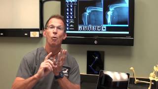 Canine ACL Tears and TPLO Surgery discussed by Dr Bauer DVM DACVS [upl. by Woodberry]