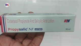 Propysalic NF Lotion  Clobetasol Propionate and Salicylic Acid Lotion  Propysalic NF Lotion Uses [upl. by Ryon]