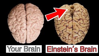 How Einsteins Brain was Different [upl. by Ailec]