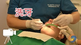 牙医教您如何正确洗牙？牙齿保健Deep Cleaning Teeth [upl. by Mctyre615]