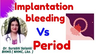 Implantation bleeding vs period  Implantation symptoms  Hindi [upl. by Saylor]