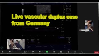 Vascular online training MOH venous duplex scan by Prof Erica Mendoza great case [upl. by Donetta]