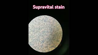 Supra vital stain  For reticulocyte count 💕 [upl. by Ahlgren]