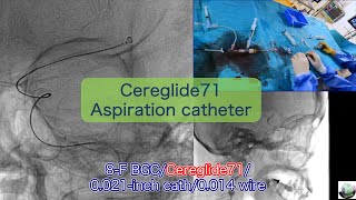 Cereglide71 Aspiration catheter for AIS 吸引カテーテル [upl. by Erodoeht]