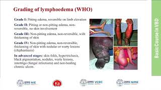 31Filariasis Clinical Features Diagnosis and Management [upl. by Clio886]